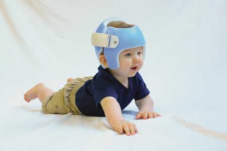 Orthologix - The STARband™ Cranial Remolding Orthosis