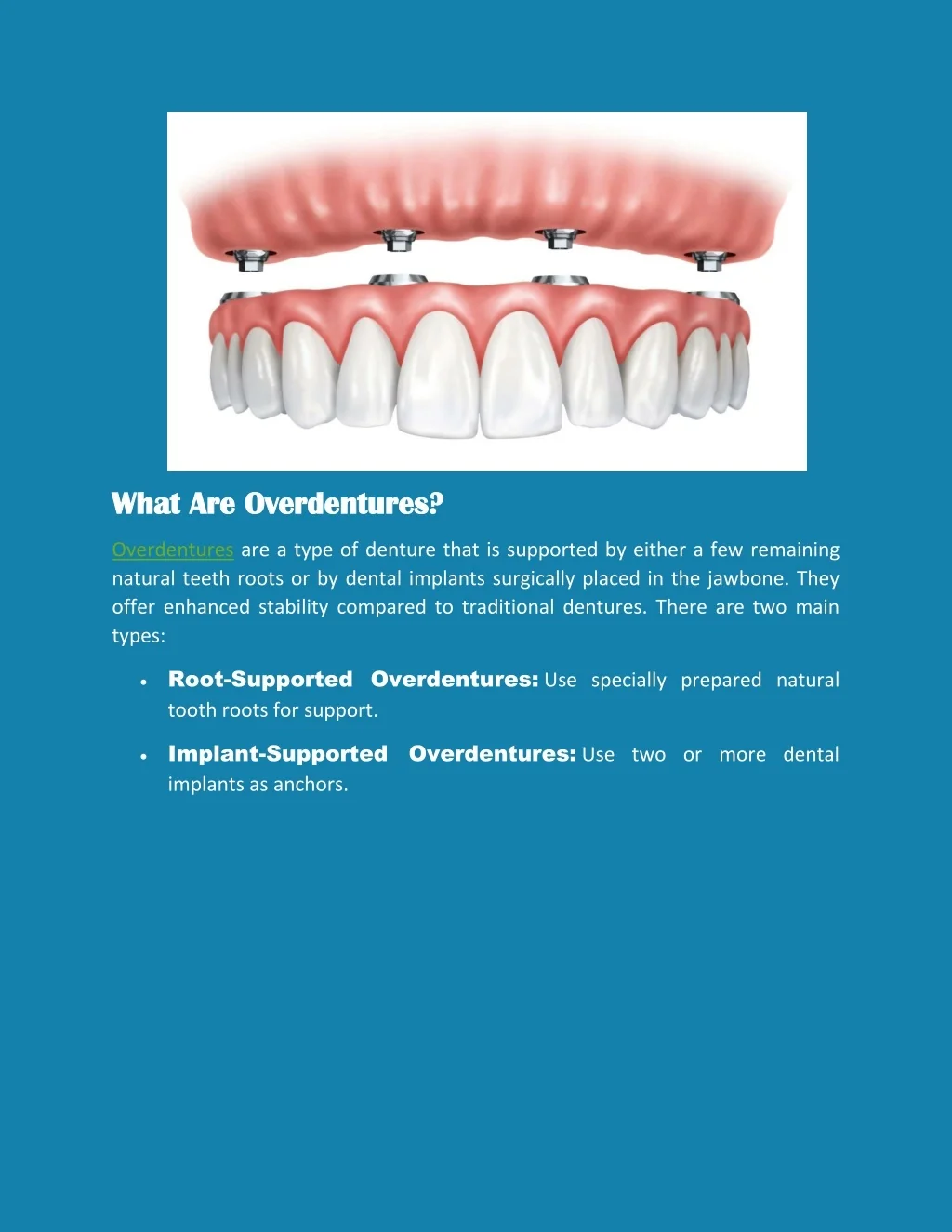 PPT - Overdentures vs. Traditional Dentures: Which Option is Right for ...