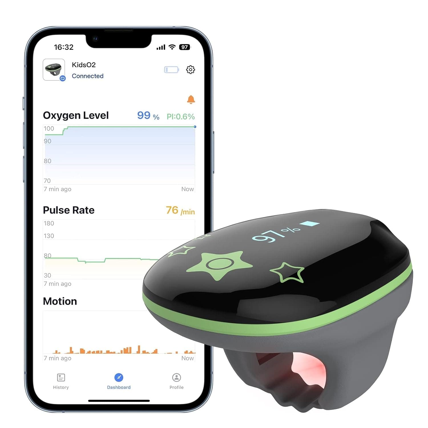 Wellue KidsO2 Ring: Portable Pulse Oximeter for Nepal | Ubuy
