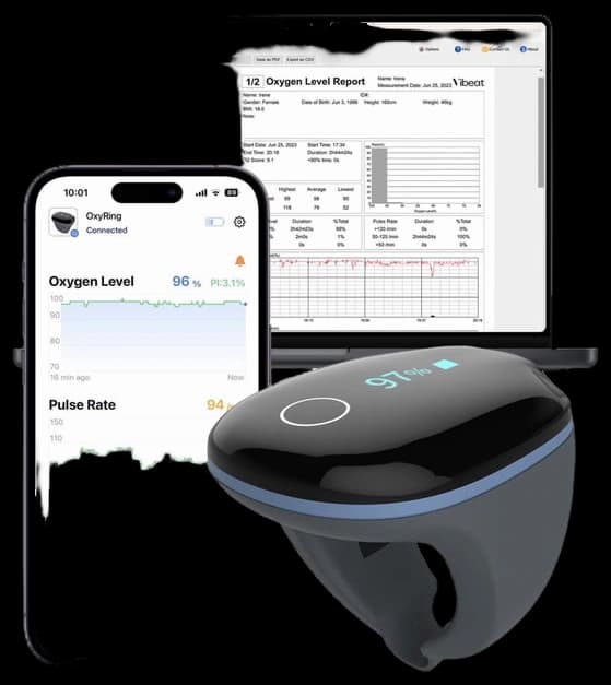 Wellue O2Ring Continuous Oxygen Monitor
