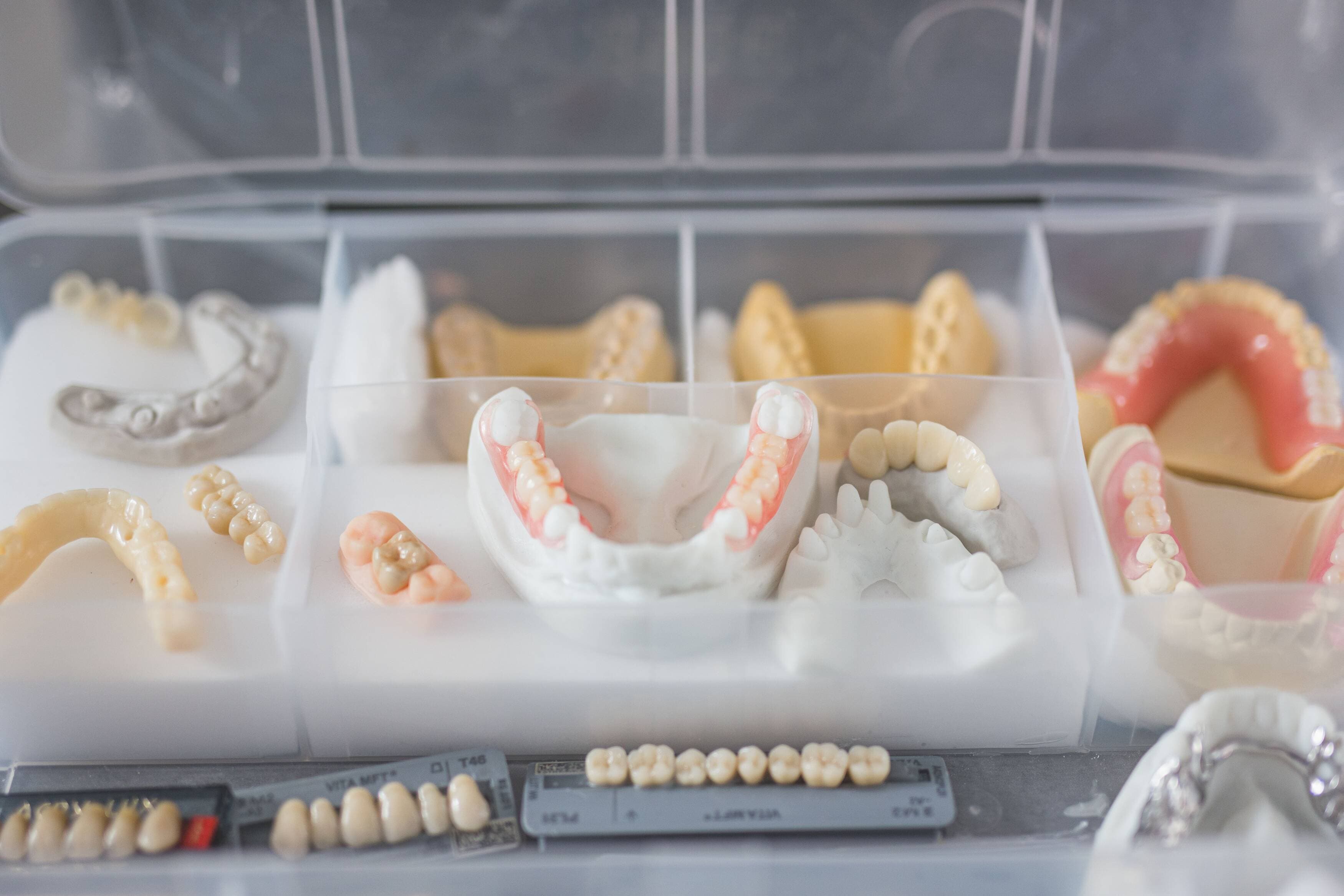 Types of Removable Partial Dentures | European Denture Center