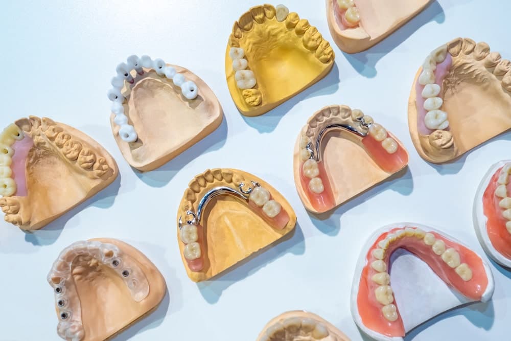 Cost of Dentures in Ontario in 2025 | Ottawa South Denture Clinic