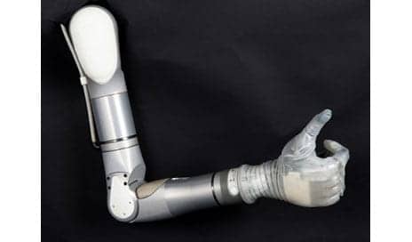 Mobius Bionics Launches LUKE Integrated Prosthetic Arm - Rehab Management