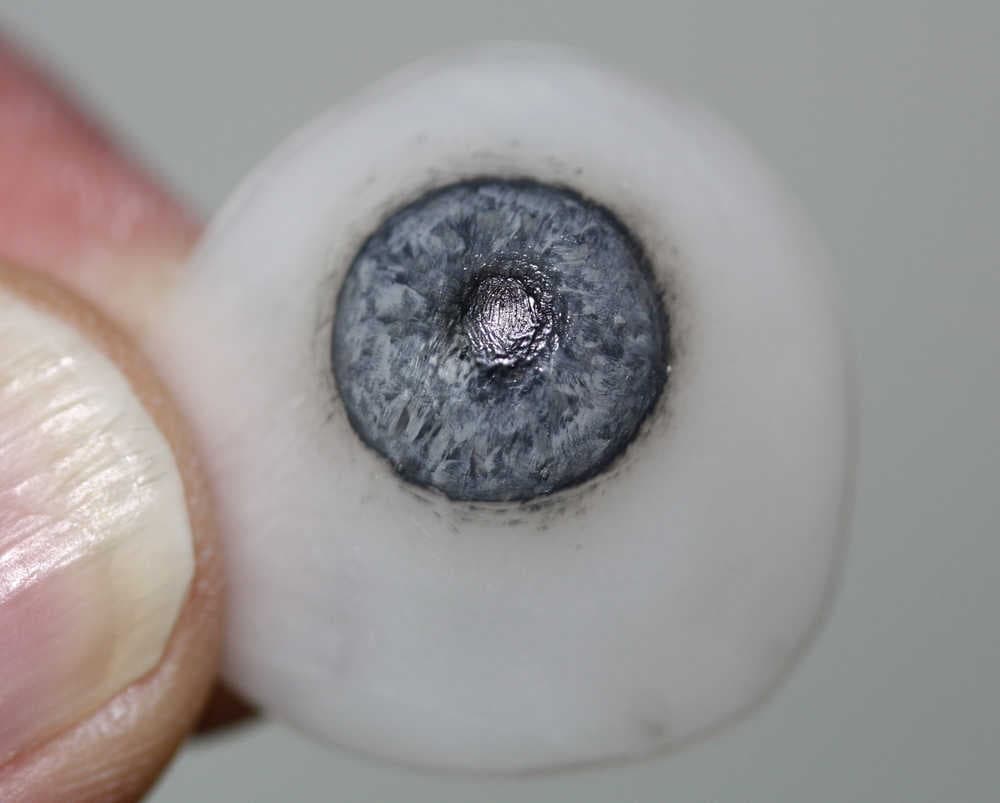 Scleral Shell Prostheses | Custom Shells for Blind Eyes